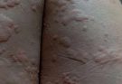 These are the consequences of sleeping co! See more